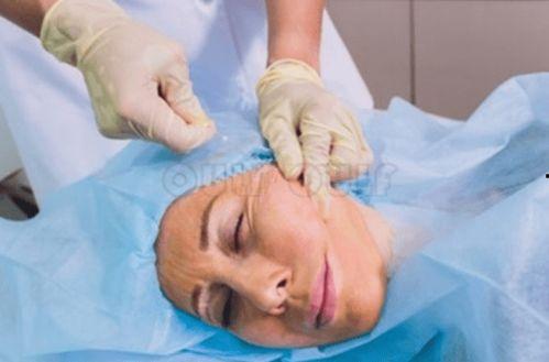 成人舌线可以割掉吗视频,安全与效果的全面解析