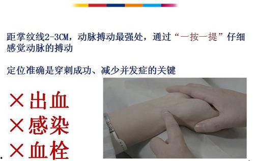 成人动脉采血手法视频,专业操作步骤解析